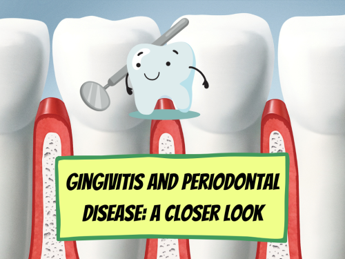 Gingivitis And Periodontal Disease A Closer Look