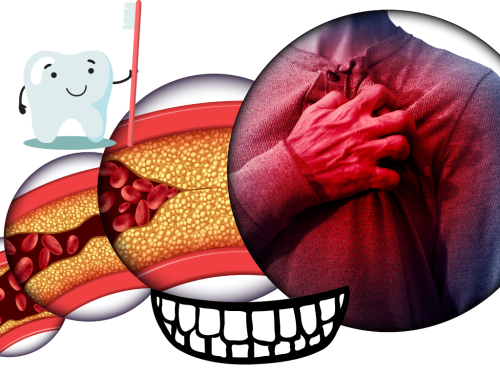 The Cardiac – Oral Health Connection